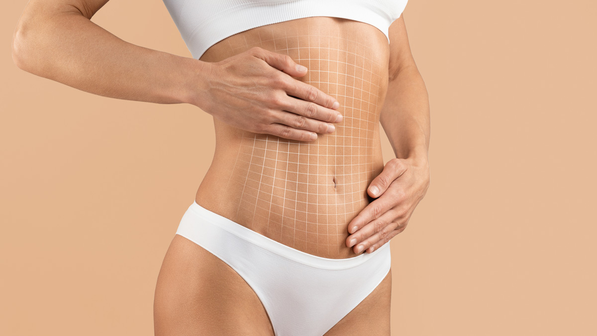 Abdominoplastik Köln