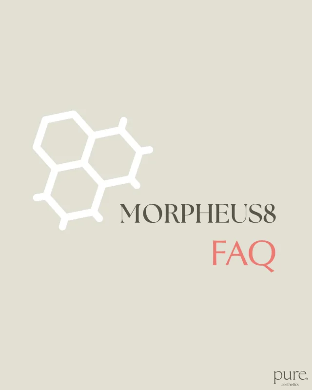 Morpheus8 – Straffere Haut ohne OP
Morpheus8 vereint Microneedling mit Radiofrequenz – für sichtbar glattere, straffere Haut und ein natürlich frisches Aussehen.
Feine Linien, erschlaffte Partien und unebenes Hautbild werden gezielt behandelt.
Nach der Behandlung: kurze Ausfallzeit, natürliche Regeneration.

👉🏼 Für eine individuelle Beratung stehen wir dir jederzeit zur Verfügung.

PA_Pure Aesthetics GmbH
📍Kolumbastraße 10, 50667 Köln
✉️ info@pa-pure.com
📞 +49 (0)221 2921760
🌐 pa-pure.com